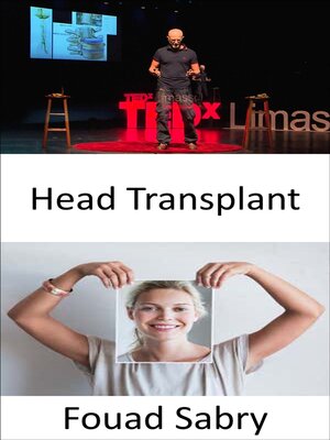 cover image of Head Transplant